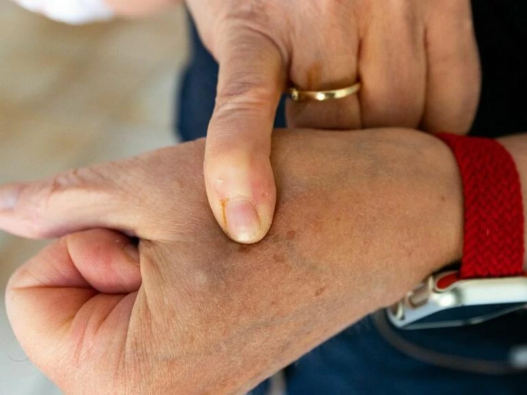 Frau trägt Chip im Handgelenk