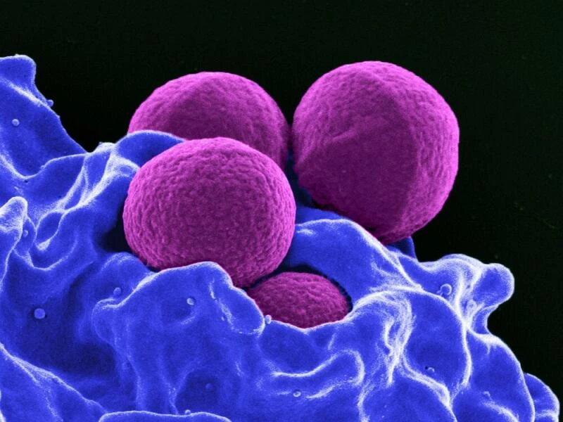 MRSA - Antibiotika-Resistenz