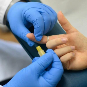 HIV-Test