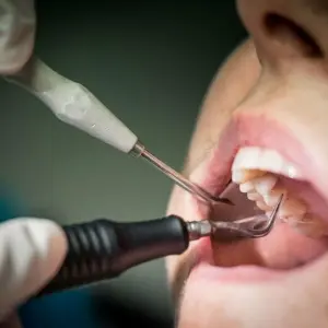 Beim Zahnarzt