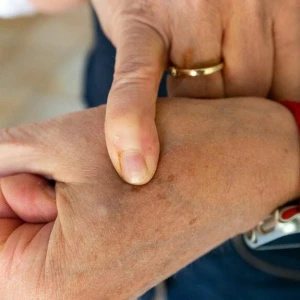 Frau trägt Chip im Handgelenk