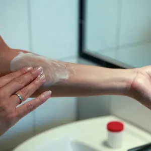 Frau cremt Arm mit einer Salbe ein