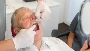 Ein Mann mit offenem Mund in Behandlung beim Zahnarzt.