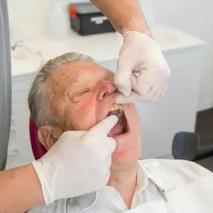 Ein Mann mit offenem Mund in Behandlung beim Zahnarzt.
