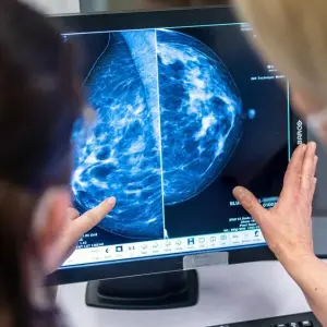 Mammographie zur Brustkrebs-Früherkennung