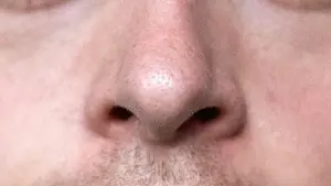 Nase eines Mannes